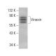 Vinexin Antibody (D-4) - Western Blotting - Image 384049 