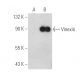 Vinexin Antibody (D-4) - Western Blotting - Image 388968