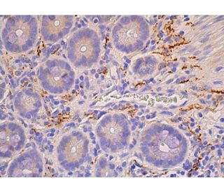 western blotting image from recommended VIP (H-6) monoclonal antibody replacement. Image 384625