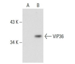 VIP36 Antibody (264C4a) - Western Blotting - Image 47184 