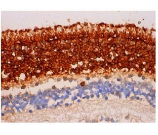 Visual Arrestin Antibody (E-3) - Immunohistochemistry - Image 346399 