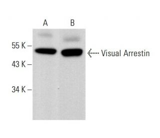 Visual Arrestin Antibody (F-2) - Western Blotting - Image 376403 