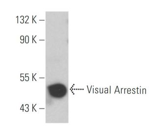 Visual Arrestin Antibody (PDS-1) - Western Blotting - Image 10595