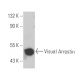 Visual Arrestin Antibody (PDS-1) - Western Blotting - Image 10595
