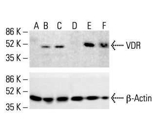 Vitamin D Receptor/VDR Antibody (D-6) - Western Blotting - Image 412276