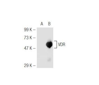 Vitamin D Receptor/VDR Antibody (D-6) - Western Blotting - Image 47139 