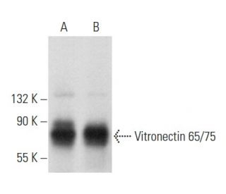 western blotting image from recommended Vitronectin 65/75 (D-8) monoclonal antibody replacement. Image 357999