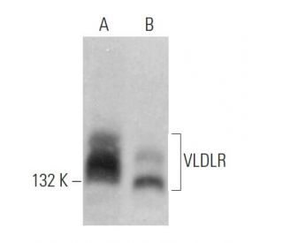VLDLR Antibody (6A6) - Western Blotting - Image 362061
