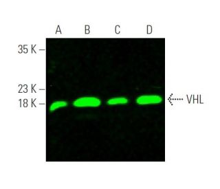 Von Hippel Lindau/VHL Antibody (VHL40) - Western Blotting - Image 375695