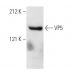 VP5 Antibody (6F10) - Western Blotting - Image 5619