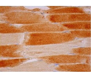 immunohistochemistry image from recommended VPAC1 (B-4) monoclonal antibody replacement. Image 293485