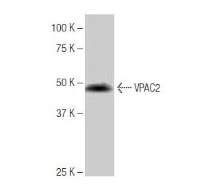 western blotting image from recommended VPAC2 (5B3) monoclonal antibody replacement. Image 65097