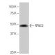 western blotting image from recommended VPAC2 (5B3) monoclonal antibody replacement. Image 65097