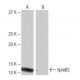 VpreB3 Antibody (FT-32) - Western Blotting - Image 65098