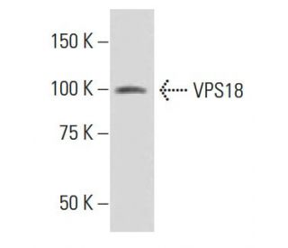 VPS18 Antibody (237.1) - Western Blotting - Image 34260 