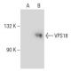 VPS18 Antibody (237.1) - Western Blotting - Image 48765
