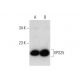 VPS25 Antibody (D-6) - Western Blotting - Image 135485 
