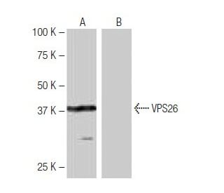 VPS26 Antibody (10L3) - Western Blotting - Image 65099