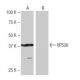 VPS26 Antibody (10L3) - Western Blotting - Image 65099