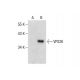 VPS26 Antibody (E-3) - Western Blotting - Image 287607