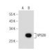 VPS28 Antibody (B-2) - Western Blotting - Image 155285 