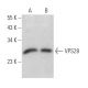 VPS28 Antibody (B-2) - Western Blotting - Image 365977 