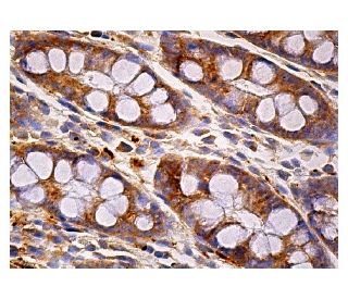 VPS28 Antibody (E-10) - Immunohistochemistry - Image 159204 