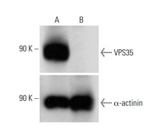 VPS35 Antibody (B-5) | SCBT - Santa Cruz Biotechnology