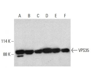 VPS35 Antibody (B-5) - Western Blotting - Image 385736 