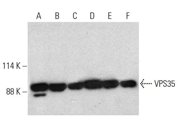 ma5ページ VPS35 Antibody (B-5) | SCBT - Santa Cruz Biotechnology