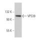 VPS39 Antibody (C-5) - Western Blotting - Image 360784 