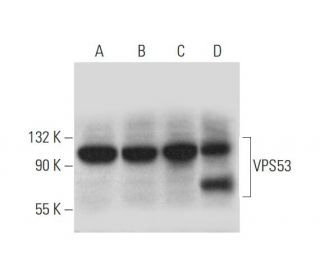VPS53 Antibody (H-4) - Western Blotting - Image 333588 