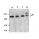 western blotting image from recommended VR1 (E-8) monoclonal antibody replacement. Image 376085