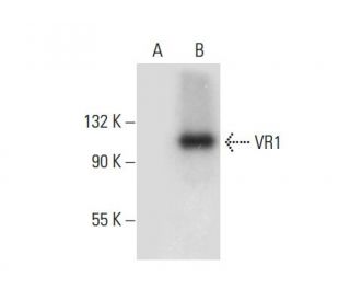 VR1 (E-8): sc-398417. Western blot analysis of VR1 expression in...