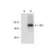 VR1 (E-8): sc-398417. Western blot analysis of VR1 expression in...