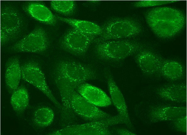 vwf-antibody-c-12-