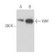This polyclonal antibody has been discontinued. See our recommended <a href="vwf-antibody-f8-86">von Willebrand Factor/VWF (F8/86)</a> monoclonal antibody (sample data shown). western blotting image from recommended von Willebrand Factor/VWF (F8/86) monoclonal antibody replacement. Image 16281
