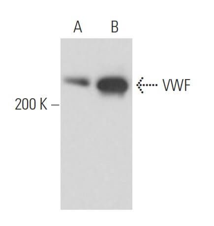 von Willebrand Factor/VWF Antibody (F8/86) | SCBT - Santa Cruz