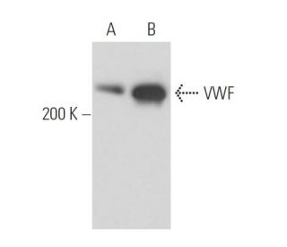 western blotting image from recommended von Willebrand Factor/VWF (F8/86) monoclonal antibody replacement. Image 16281