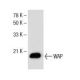 WAP Antibody (C-10) - Western Blotting - Image 154922 