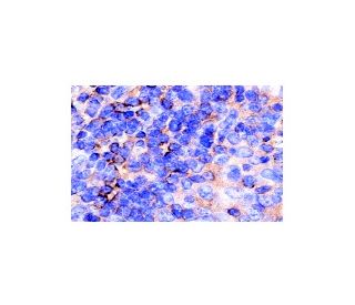 WASP Antibody B 9