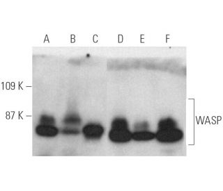 WASP Antibody B 9 SCBT Santa Cruz Biotechnology