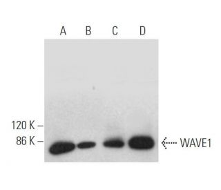 western blotting image from recommended WAVE1 (E-2) monoclonal antibody replacement. Image 373393