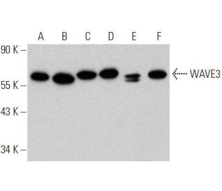 western blotting image from recommended WAVE3 (E-3) monoclonal antibody replacement. Image 359373