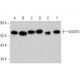 This polyclonal antibody has been discontinued. See our recommended <a href="wave3-antibody-e-3">WAVE3 (E-3)</a> monoclonal antibody (sample data shown). western blotting image from recommended WAVE3 (E-3) monoclonal antibody replacement. Image 359373