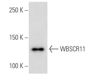 WBSCR11 Antibody (GTF5I102) - Western Blotting - Image 16836 