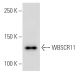 WBSCR11 Antibody (GTF5I102) - Western Blotting - Image 16836 