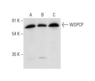 WDPCP Antibody (A-5) - Western Blotting - Image 314040Each CRISPR/Cas9 Knockout (KO) Plasmid product consists of a pool of 3 plasmids designed to ensure identification and cleavage of a specific gene for maximum knockout efficiency. Each plasmid encodes a unique 20 nt sequence derived from the GeCKO (v2) library. 