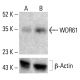 WDR61 Antibody (WW-5) - Western Blotting - Image 412763