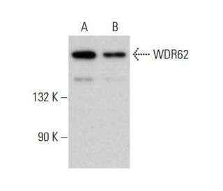 WDR62 Antibody (H-1) - Western Blotting - Image 376089 